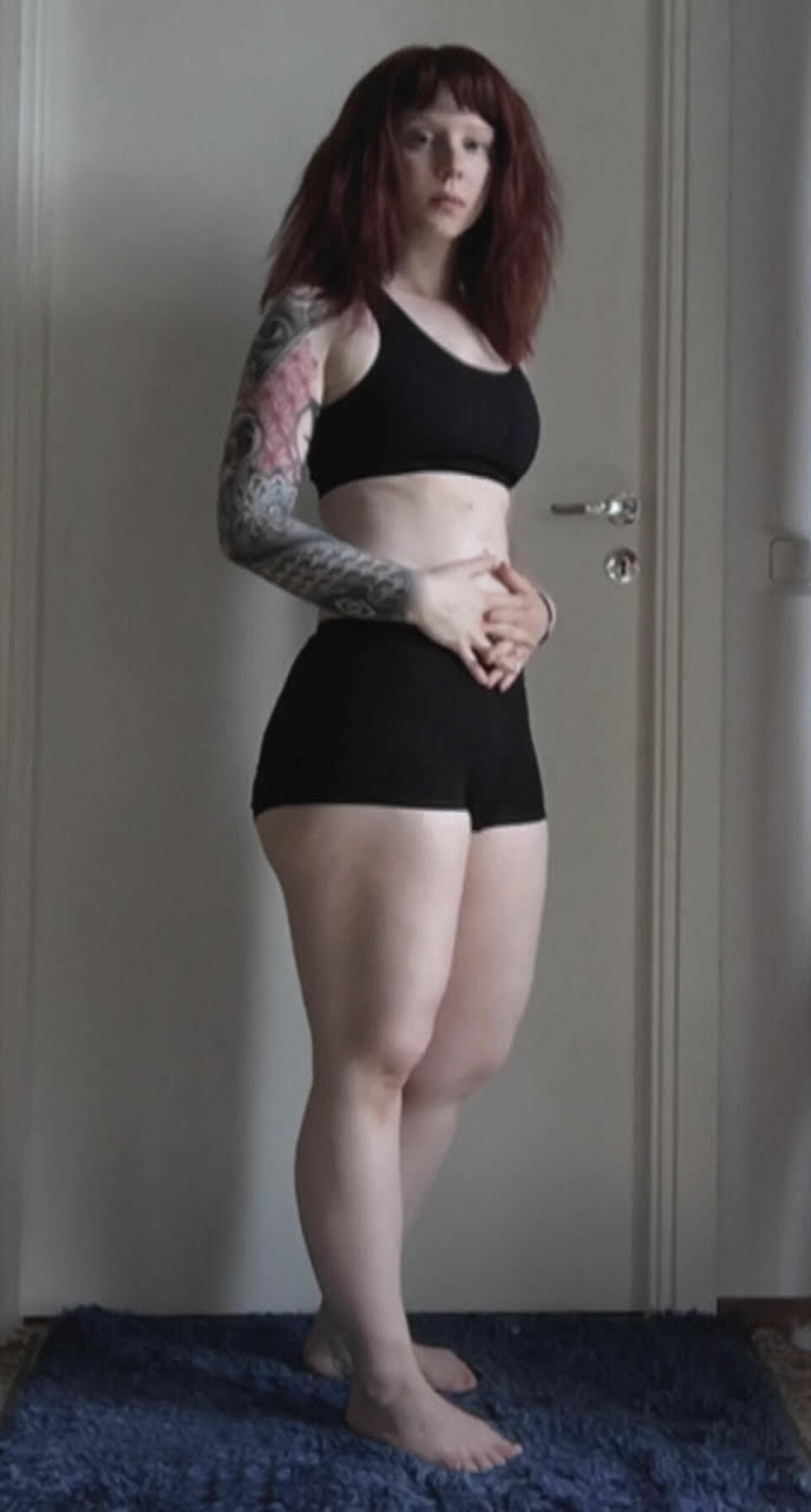 Maia, 28, har lipödem: Jag har skämts för min kropp hela livet
