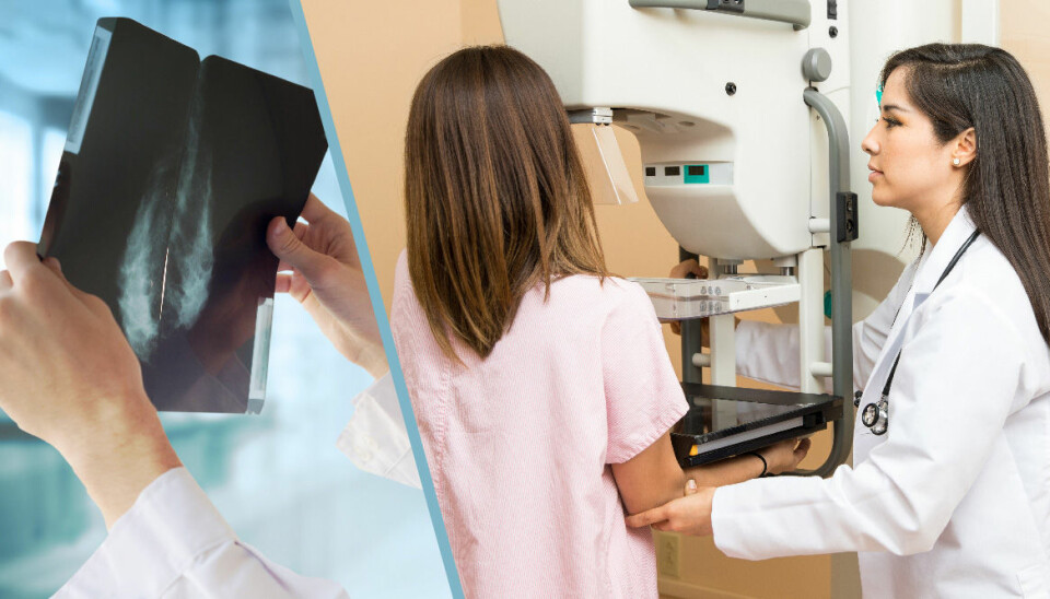 Studie: Fler bröstcancerpatienter kan slippa cellgift
