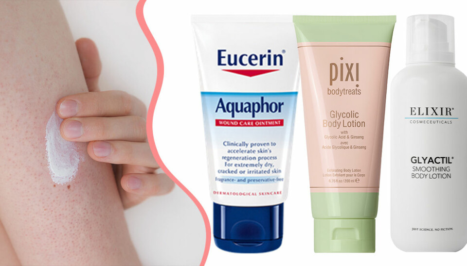 Keratosis pilaris: Så blir du av med knottror på armarna