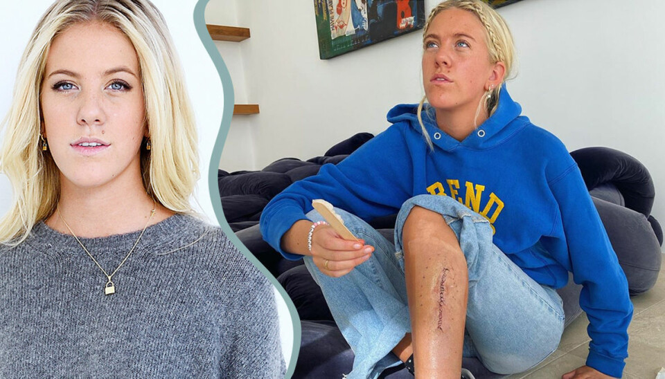 Philippa Parnevik, 20, har opererats för hudcancer