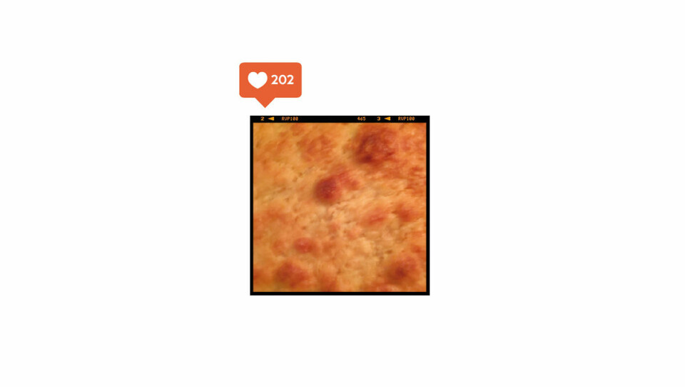 Så är livet utan filter på Instagram