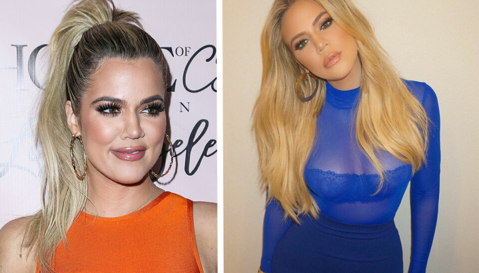 Khloé Kardashians bästa tips för vacker och fräsch hy