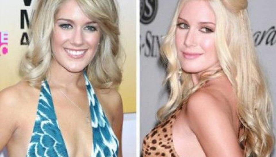 Heidi Montag har ändrat utseende genom åren. Heidi Montag har ändrat utseende genom åren.