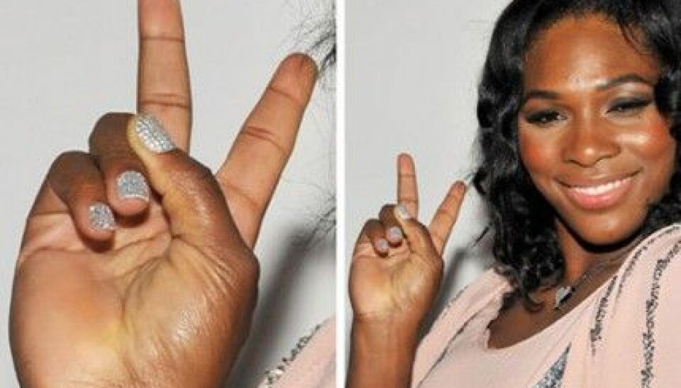 Serena Williams med strass på naglarna i oktober 2009. Serena Williams med strass på naglarna i oktober 2009.