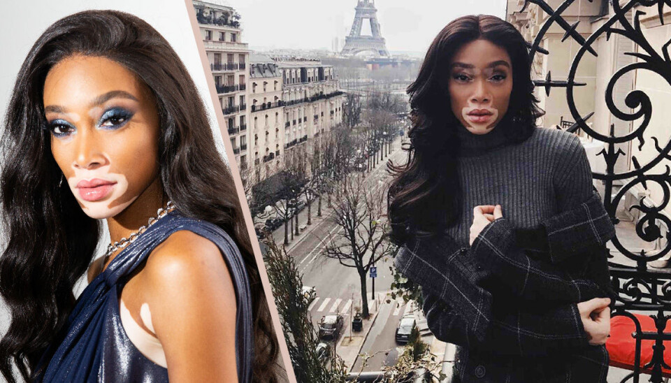 Winnie Harlow om sin vitiligo: 'Jag har lärt mig älska mig själv'