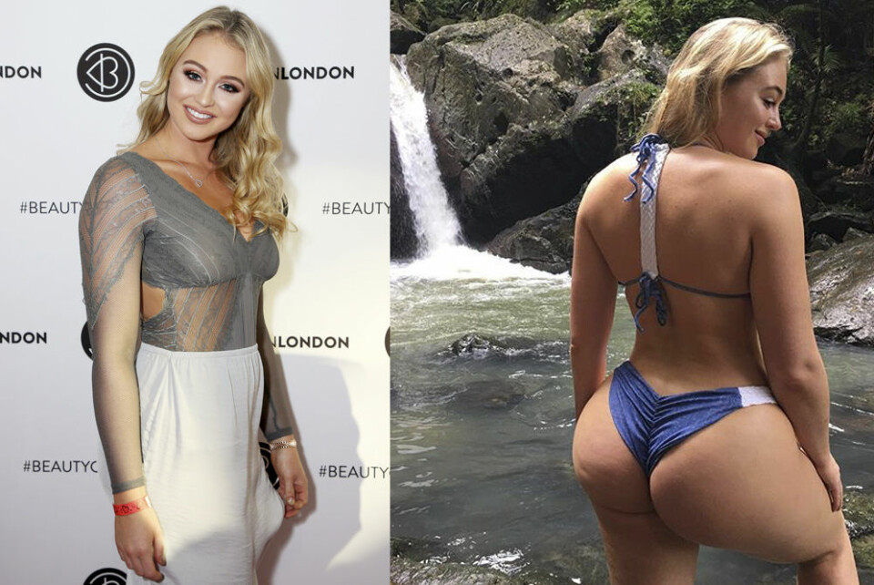 Iskra Lawrence vill belysa att både celluliter och bristningar är helt vanligt.