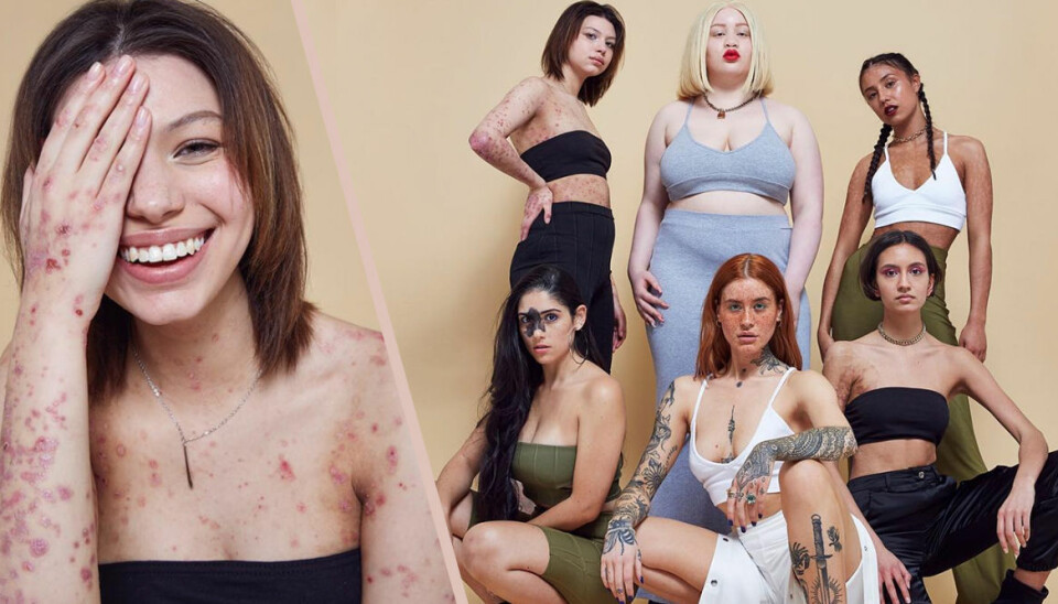 Missguideds nya reklamkampanj utmanar skönhetsideal – se de hyllade bilderna här