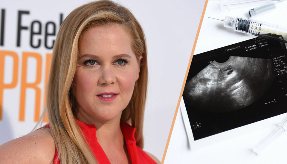Amy Schumers nya ord om IVF-resan och gravidkampen