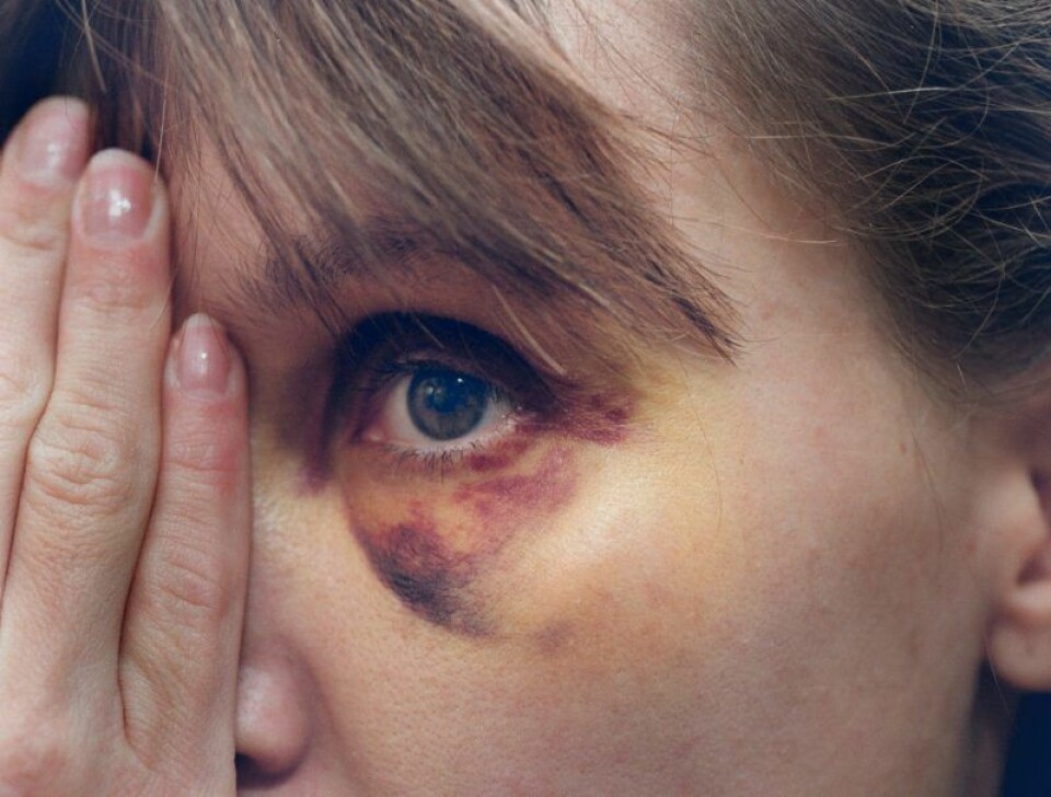 ”Du vet aldrig när misshandeln går över i dödligt våld”, säger Åsa. ”Du vet aldrig när misshandeln går över i dödligt våld”, säger Åsa.