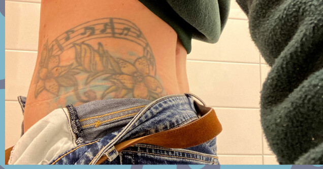 Notbandet fortsätter som ett S ner en bit på skinkan, här syns ungefär halva konststycket. Foto: Givetvis privat Notbandet fortsätter som ett S ner en bit på skinkan, här syns ungefär halva konststycket. Foto: Givetvis privat