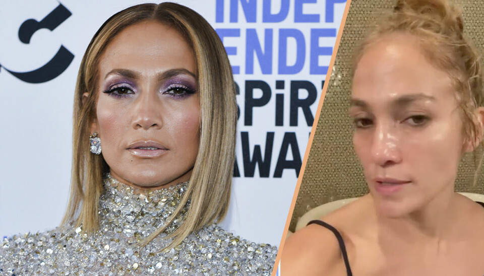 Jennifer Lopez berättar öppet om botox – efter anklagelserna