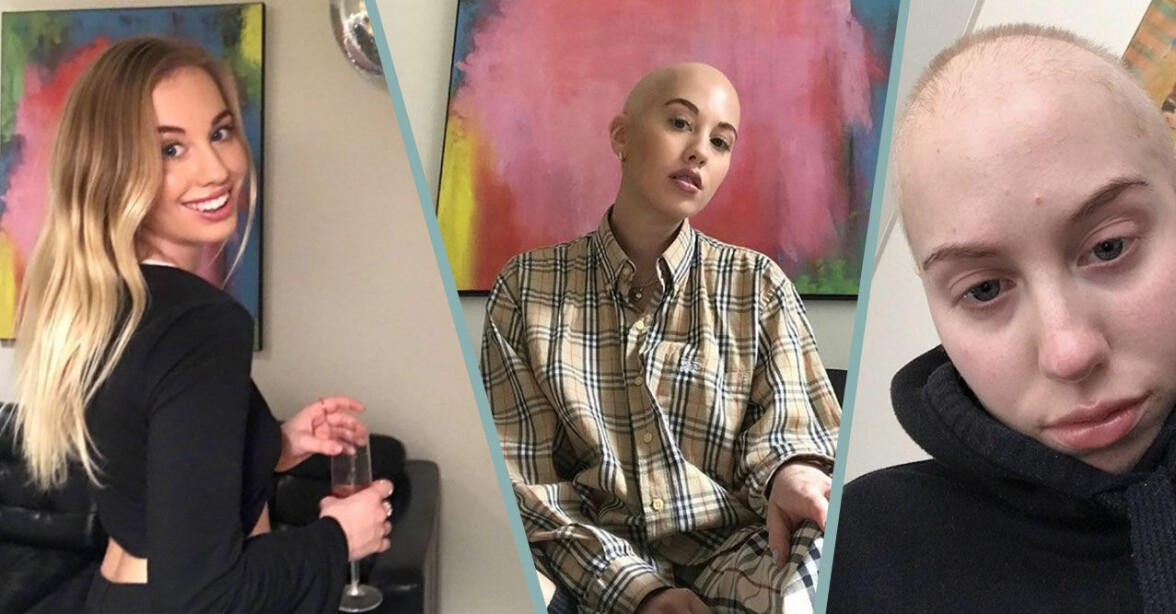Lovisa, 21, hade tumör stor som en handboll i magen