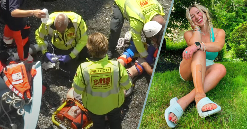 Jamie, 20, föll från en klippa – överlevde mirakulöst