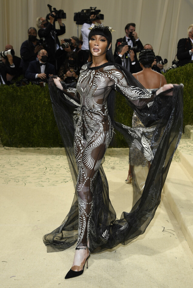 Winnie Harlow. Winnie Harlow.