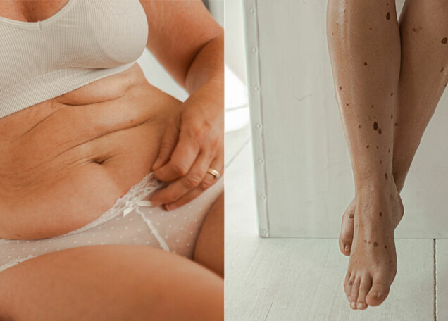 Därför jämför vi oss med ett ouppnåeligt ideal