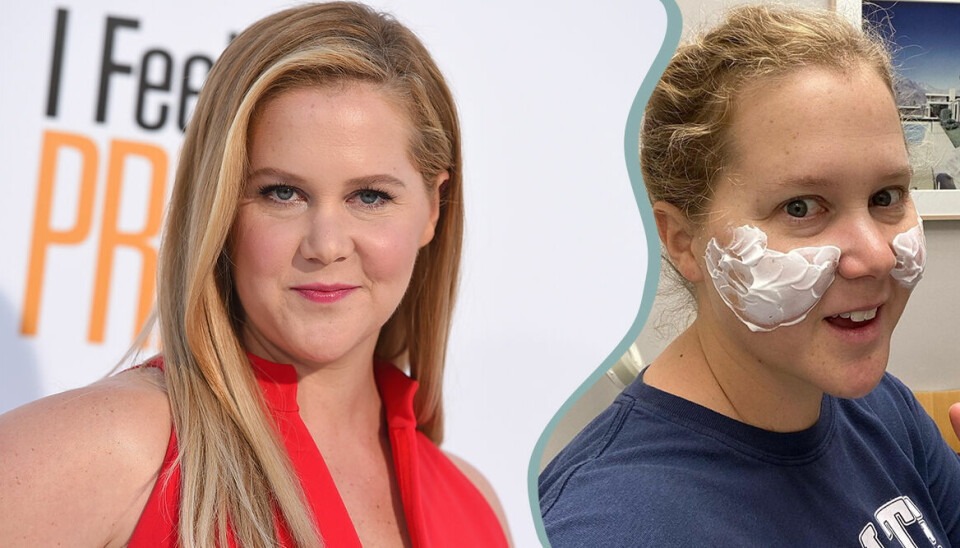 Amy Schumer berättar om misslyckade skönhetsingreppet