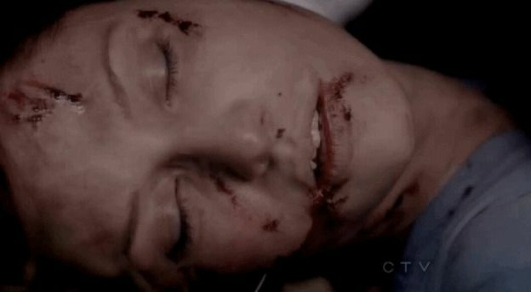 Grey's Anatomy