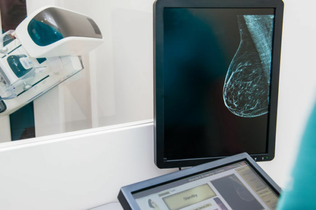 Bild av bröst under pågående mammografi.