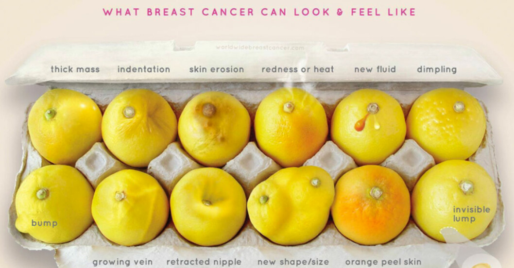 Den här bilden kan hjälpa dig att upptäcka bröstcancer